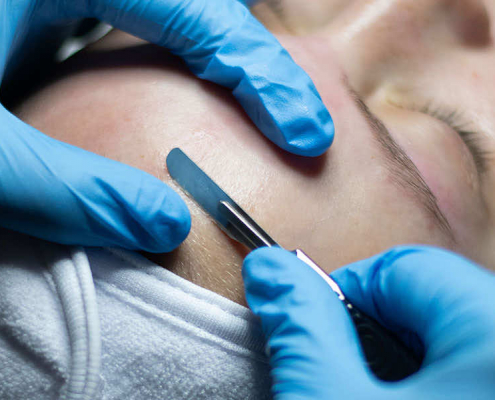 woman getting facial with dermaplaning