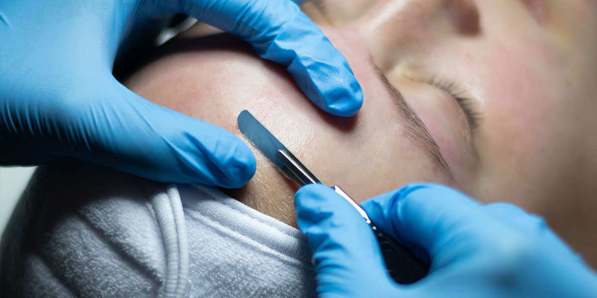 woman getting facial with dermaplaning