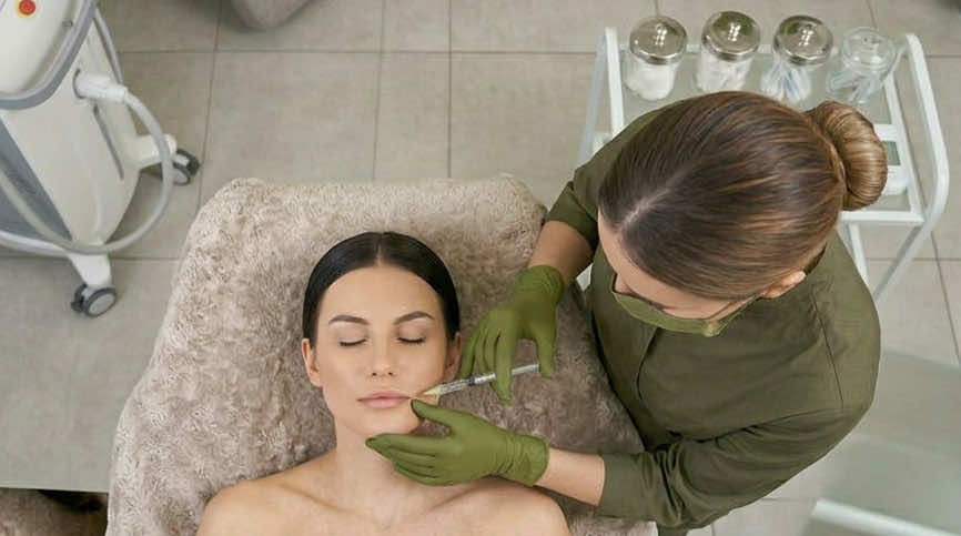 dermal filler marionette lines in wimborne